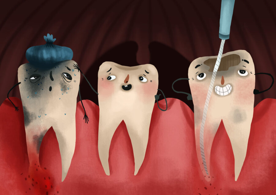 graphic of aching tooth receiving root canal therapy showing how it can save a tooth from extraction